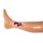Wundmoulage Ulcus Cruris Arteriosum, klein, Exsudationsphase