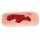 Wundmoulage Ulcus Cruris Arteriosum, klein, Granulationsphase