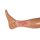 Wound moulage arterial leg ulcer, small, epithelization phase