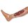 Wound moulage arterial leg ulcer, large, exudation phase