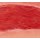 Wound moulage arterial leg ulcer, large, granulation phase