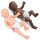 Special needs Infant