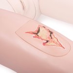 Wound depictions for upper arm and thigh for P10 and P11
