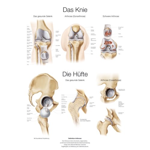 Lehrtafel "Das Knie / Die Hüfte (DE)"