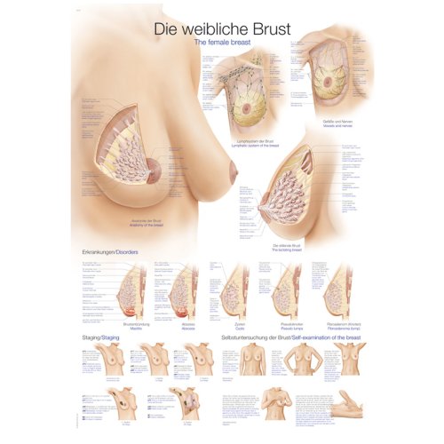 Lehrtafel "Die weibliche Brust", 70x100cm