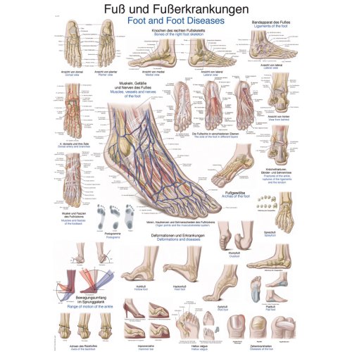 Chart Foot and foot diseases, 50x70cm