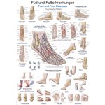 Chart Foot and foot diseases, 70x100cm