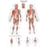 Chart Trigger points, 50x70cm