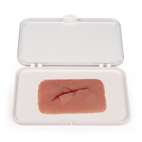 Wundmoulage Schnittwunde mit Glassplitter