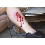 "Wound moulage ""laceration"""