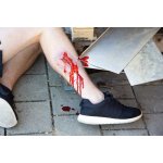"Wound moulage ""laceration"""