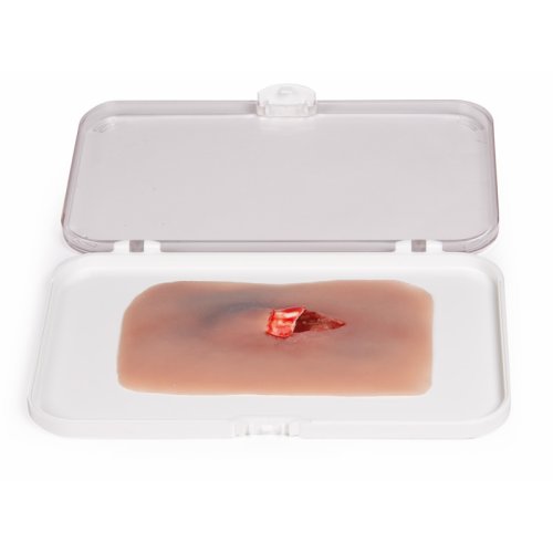 "Wound moulage ""open fracture"""