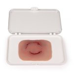 "Wound moulage ""human bite"""