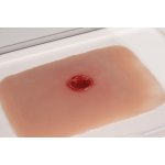 Wound moulage bullet entrance hole