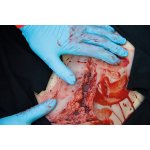 Wound moulage laceration, large with bleeding function
