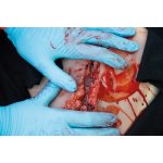 Wound moulage laceration, large with bleeding function