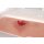 Wound moulage open fracture, arm bone with bleeding function