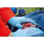 Wound moulage open fracture, leg with bleeding function