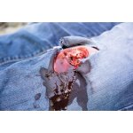 Wound moulage open fracture, leg with bleeding function