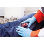 Wound moulage open fracture, leg with bleeding function