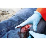Wound moulage open fracture, leg with bleeding function