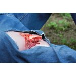 Wound moulage open fracture, leg with bleeding function