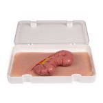 Wound moulage protrusion of large intestines