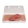 Wound moulage protrusion of large intestines