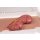 Wound moulage protrusion of large intestines