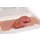 Wound moulage protrusion of large intestines