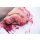 Wound moulage protrusion of large intestines