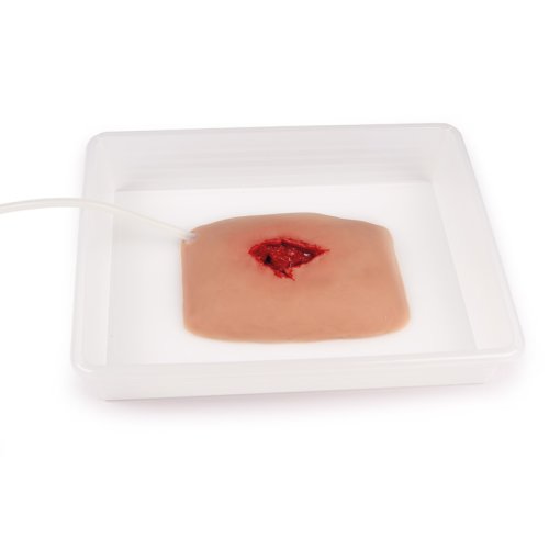 Wound moulage wound packing