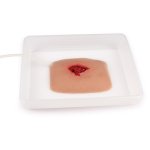 Wound moulage wound packing