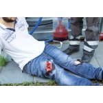 Wound moulage wound packing