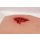 Wound moulage wound packing