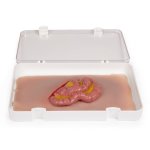 Wound moulage protruding small intestines