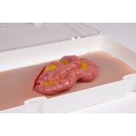 Wound moulage protruding small intestines