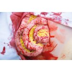 Wundmoulage Dünndarmaustritt