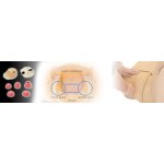 "Hana" Module Cervical Examination