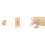 "Hana" Module Perineal tear