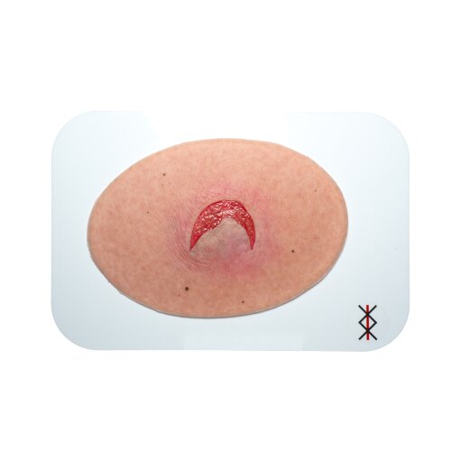Stick-On Medium Skin Tears