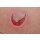 Stick-On Medium Skin Tears