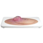 Stick-On Medium Ulcerierendes Mamma-CA (Brusttumor)
