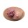 Stick-On Medium Ulcerierendes Mamma-CA (Brusttumor)