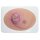 Stick-On Medium Ulcerierendes Mamma-CA (Brusttumor)