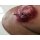 Stick-On Medium Ulcerierendes Mamma-CA (Brusttumor)