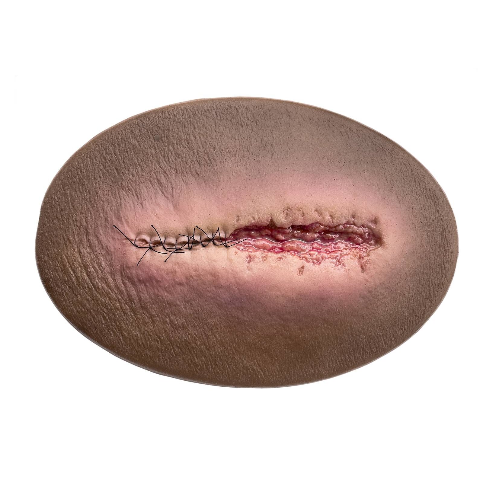OP Wunde Modell offen, entzündet MEDICAL FX MFX_fs_06