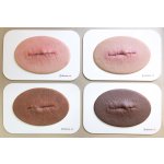 Surgical wound model sutured