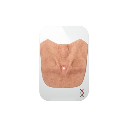 Stick-On Large Tracheostoma