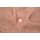Stick-On Large Tracheostoma